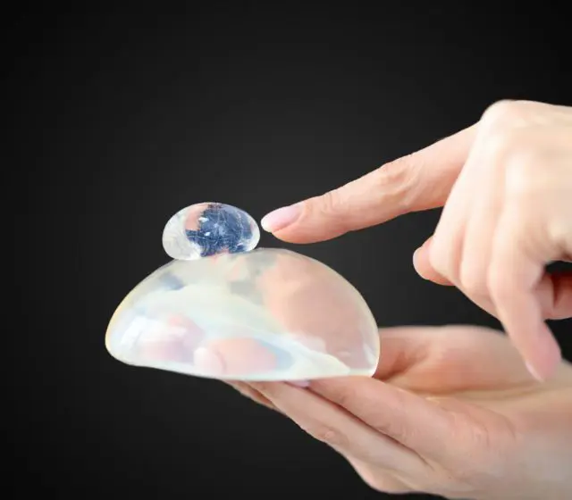 breast implant rupture