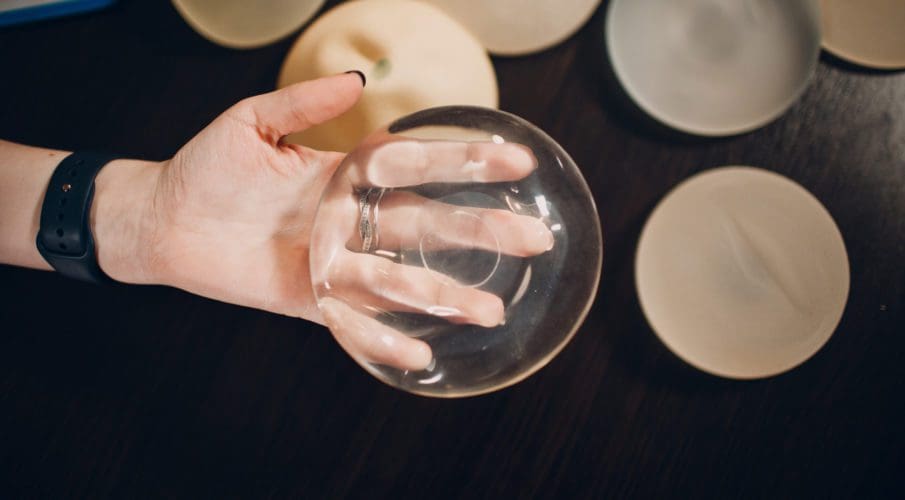 breast implant rippling 1