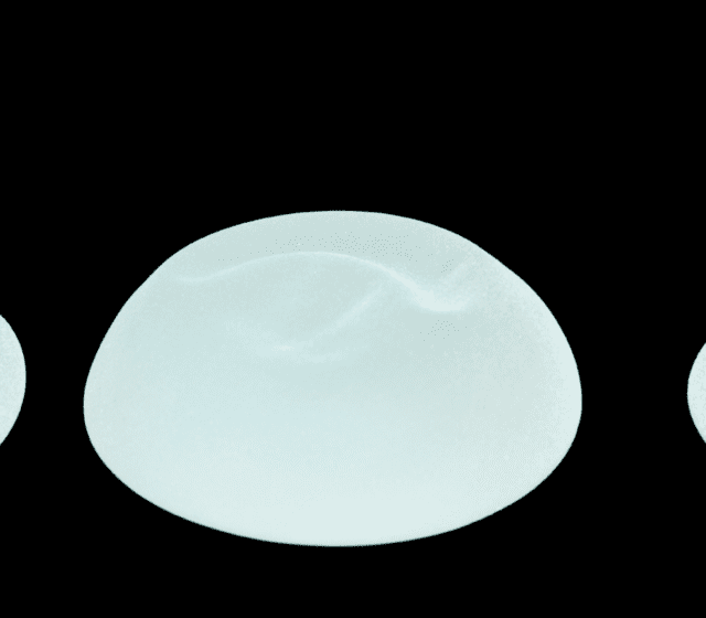breast implant removal