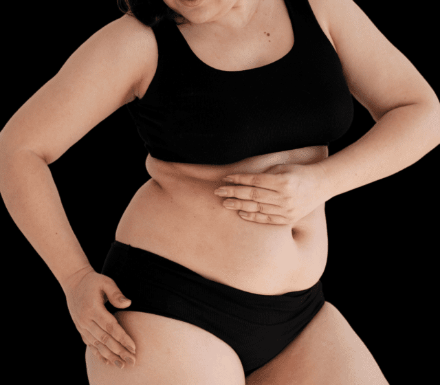 Everything You Need To Know About Lower Body Lift Or Belt Lipectomy 1 image1 6